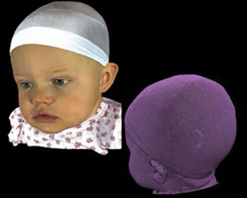 3dMDhead System